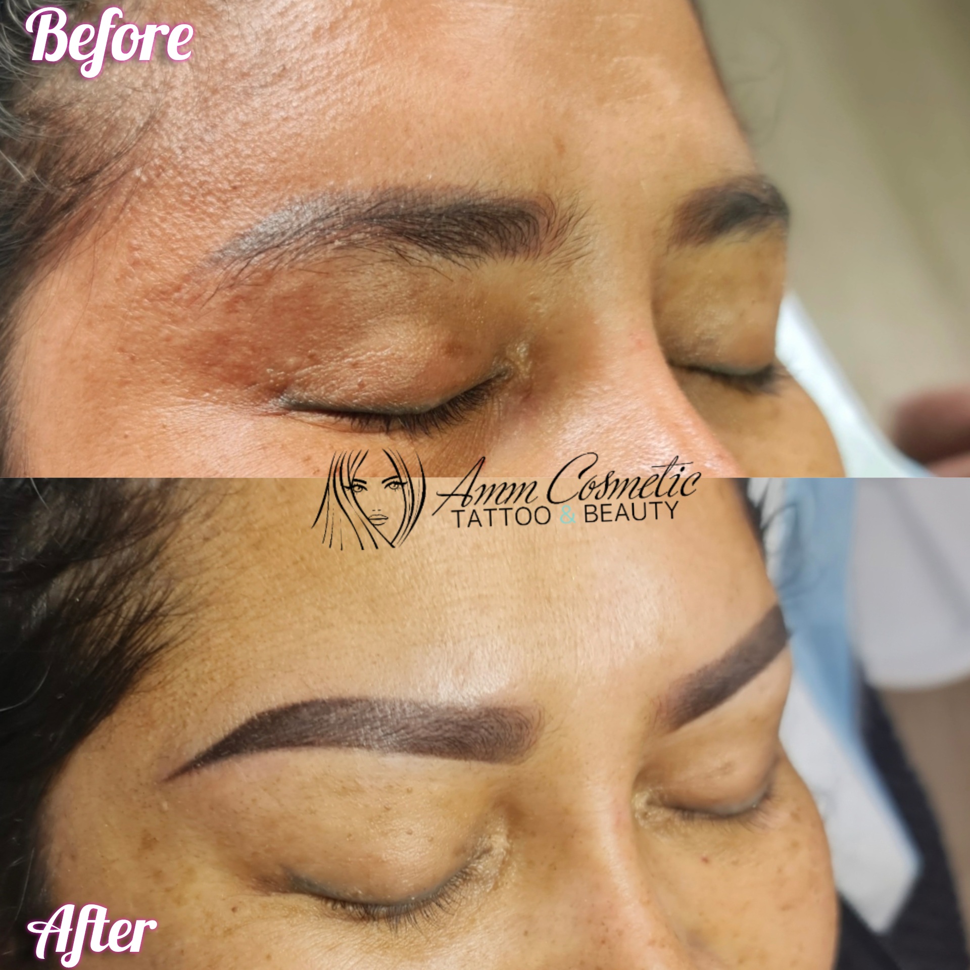 Eyebrow cosmetic tattoo
