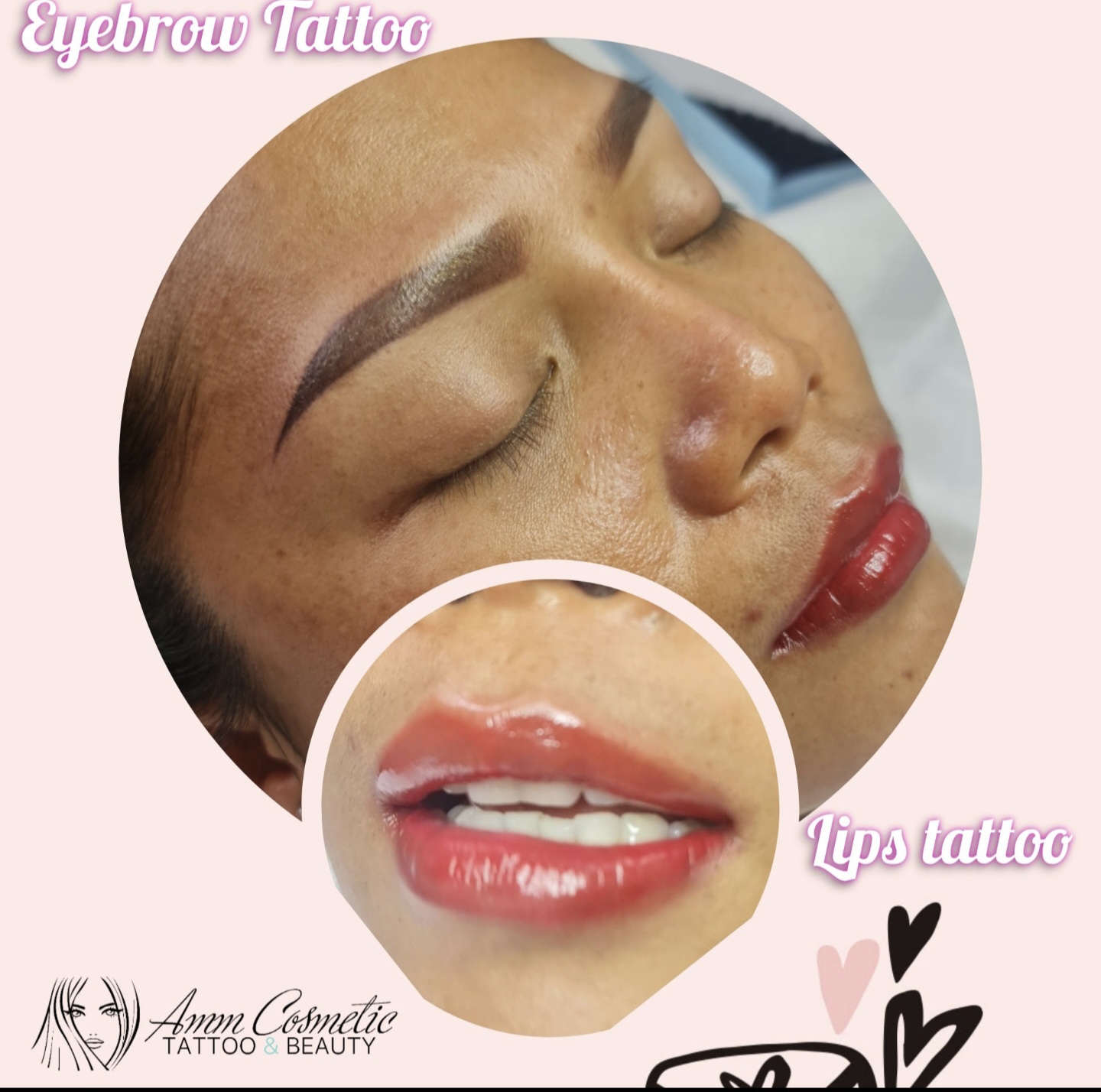 Lip tattoo result Baldivis